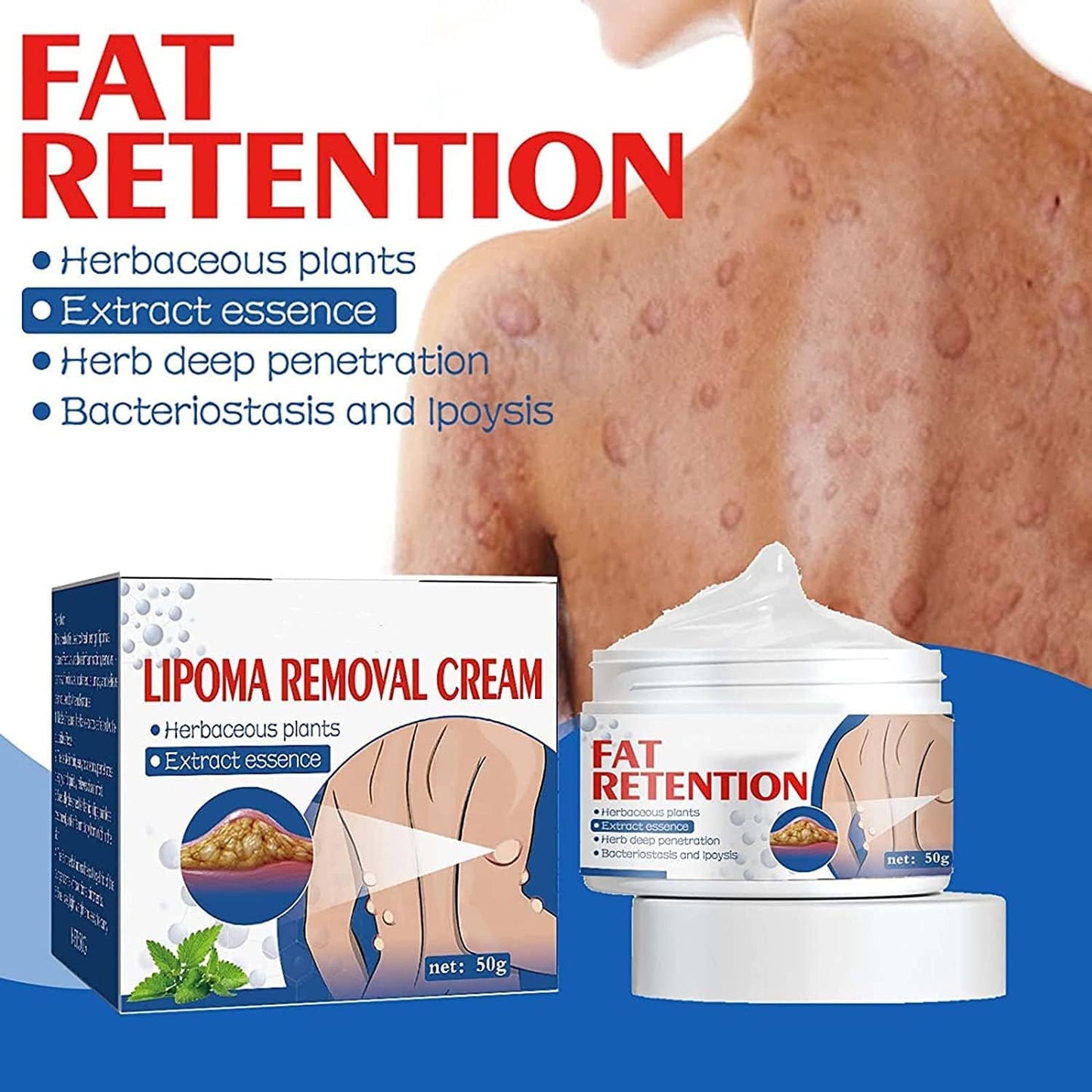 Lipoma Removal Cream